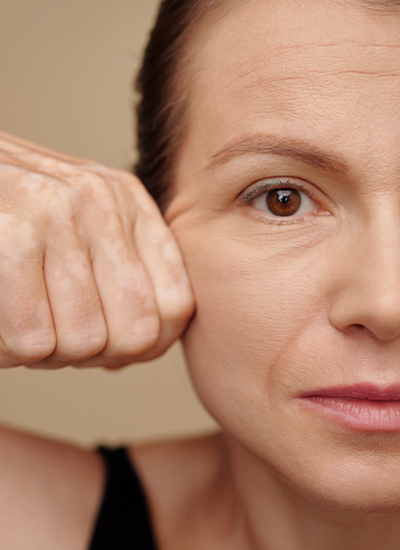 Facelift, Dr. Deb, Central Aesthetics, Plastische Chirurgie & Schönheitschirurgie in Frankfurt