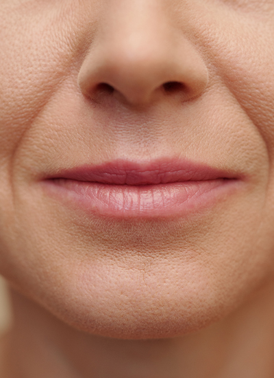 Fadenlifting, Dr. Deb, Central Aesthetics, Plastische Chirurgie & Schönheitschirurgie in Frankfurt