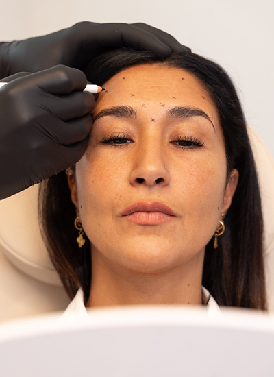 Faltenbehandlung BTX, Dr. Deb, Central Aesthetics, Plastische Chirurgie & Schönheitschirurgie in Frankfurt