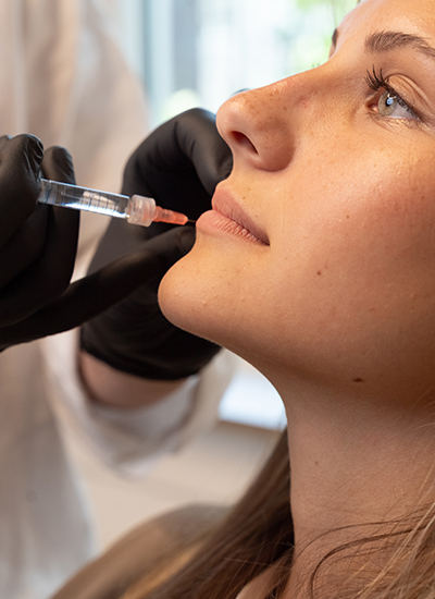 Lippen aufspritzen, Dr. Deb, Central Aesthetics, Plastische Chirurgie & Schönheitschirurgie in Frankfurt