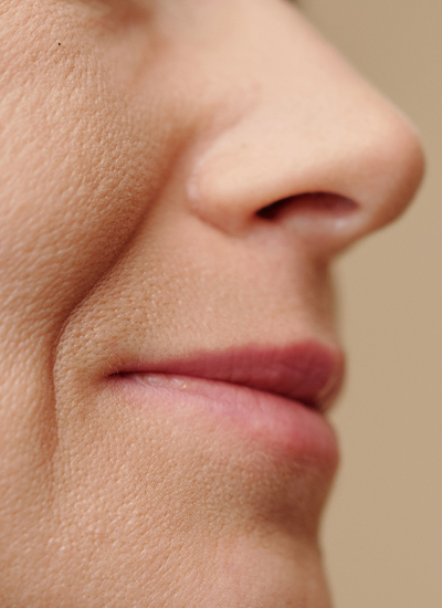 Morpheus8, Dr. Deb, Central Aesthetics, Plastische Chirurgie & Schönheitschirurgie in Frankfurt