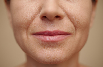 Fadenlifting in Frankfurt, Central Aesthetics