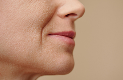 Kinnvergrößerung in Frankfurt, Central Aesthetics