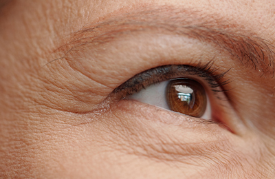 Oberlidstraffung in Frankfurt, Central Aesthetics