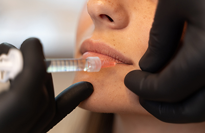 Russian Lips in Frankfurt, Central Aesthetics