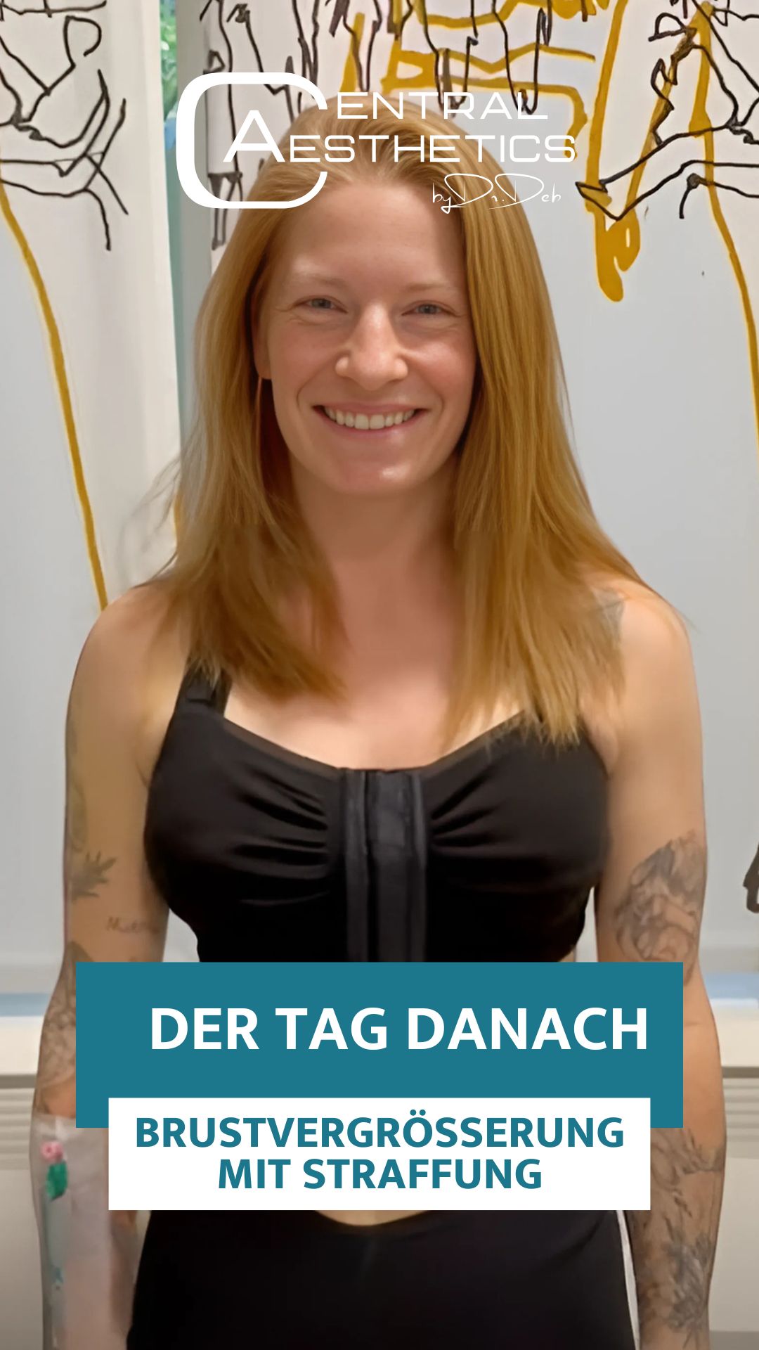 Video, Dr. Deb, Central Aesthetics, Plastische Chirurgie Frankfurt