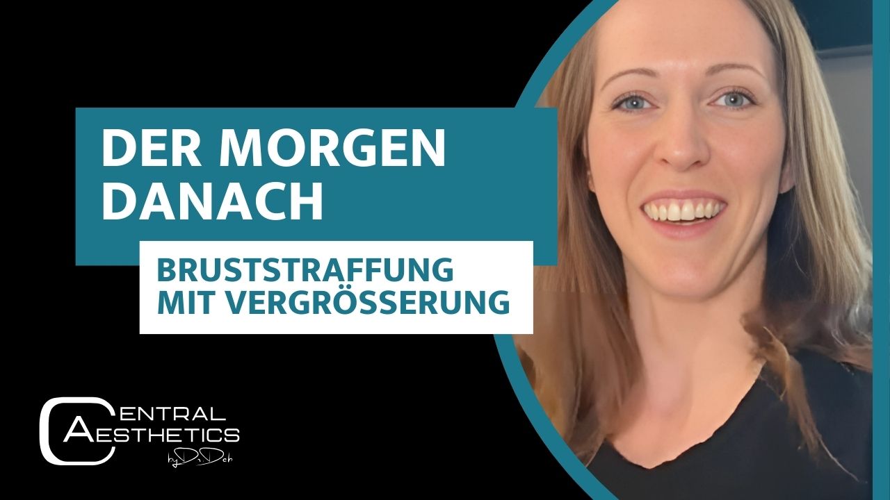 Video Bruststraffung, Dr. Deb, Central Aesthetics, Plastische Chirurgie Frankfurt