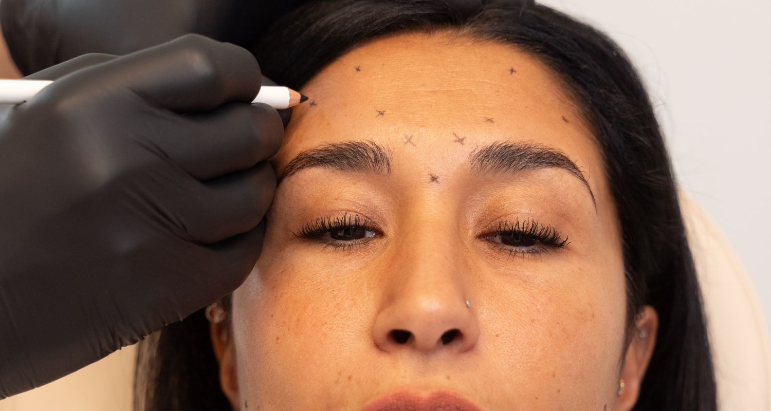 Botox bei Central Aesthetics in Frankfurt