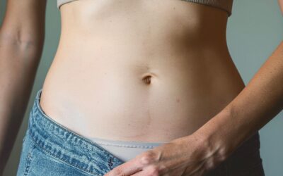 Wie lange dauert die Heilung nach einer Fettabsaugung?