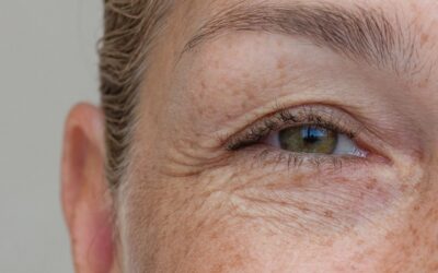 Wie lange dauert der Heilungsprozess nach einer Unterlidstraffung?