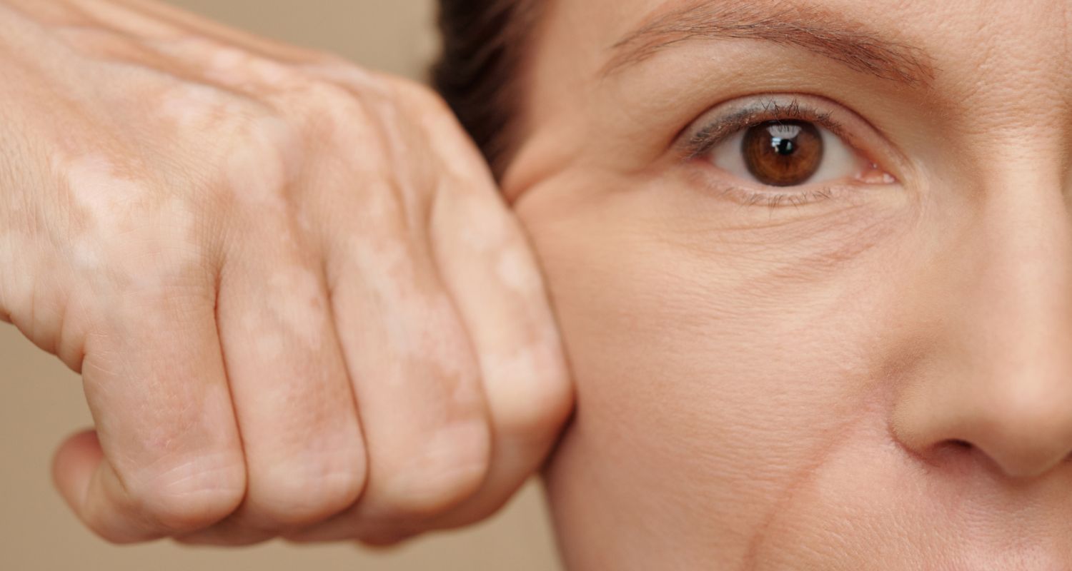 Facelift bei Central Aesthetics in Frankfurt