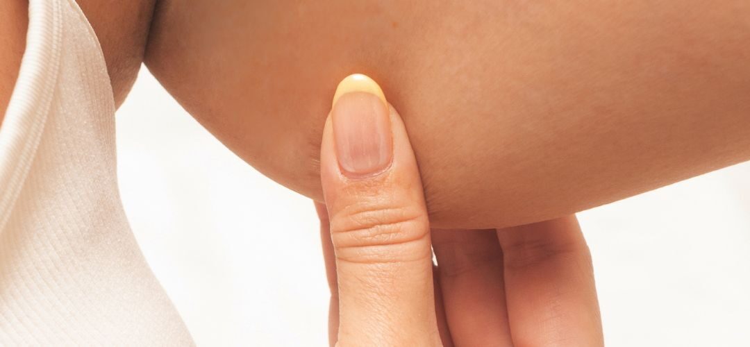 Körpereigenes Fett für die Körperformung: Lipofilling und seine Vorteile