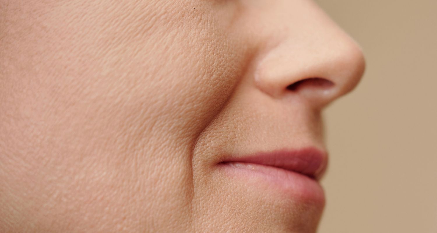 Morpheus8 bei Central Aesthetics in Frankfurt