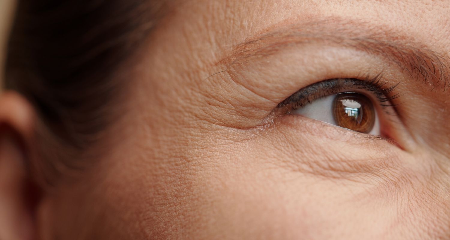 Oberlidstraffung bei Central Aesthetics in Frankfurt