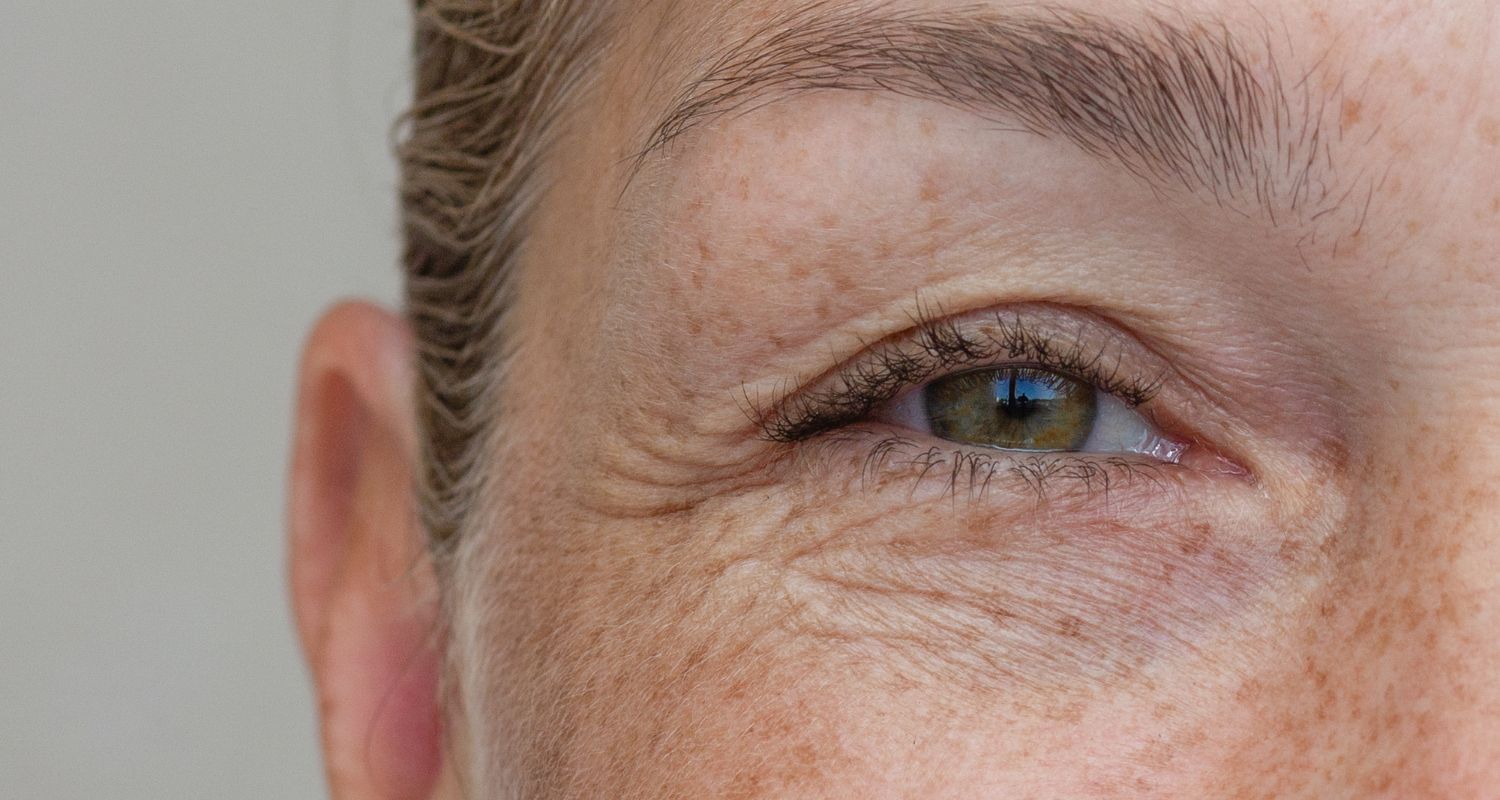 Unterlidstraffung bei Central Aesthetics in Frankfurt