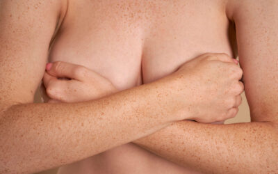 Wie lange hält das Ergebnis einer Bruststraffung?