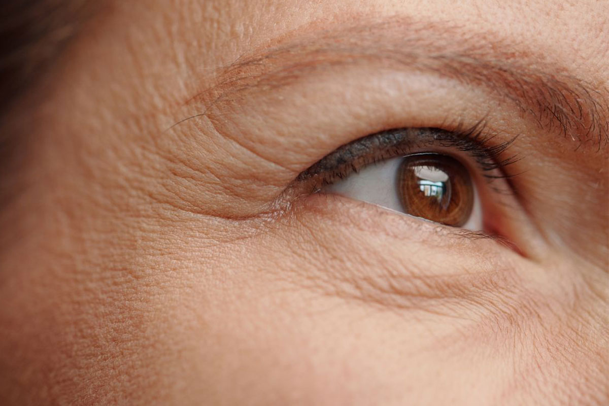 Oberlidstraffung und Unterlidstraffung bei müdem Blick